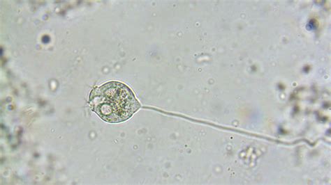  Vorticella 旋渦蟲！這微小生物的旋轉舞姿和濾食策略令人驚嘆