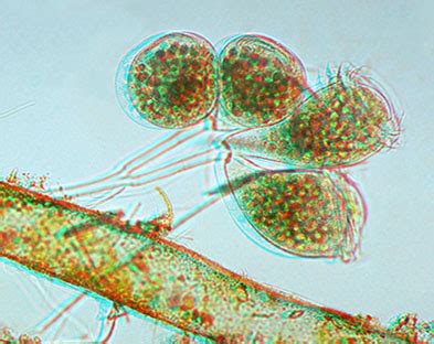  Bell Animalcules: Have You Seen These Tiny Beings that Dance Like Ballerinas with Exquisite Cilia