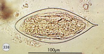   Quickly Gliding Through Water:  Quingyangtrema! A Remarkable Trematode with Unconventional Habits